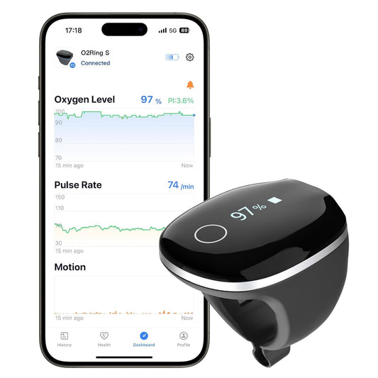 Wellue O2Ring-S Pulse Oximeter